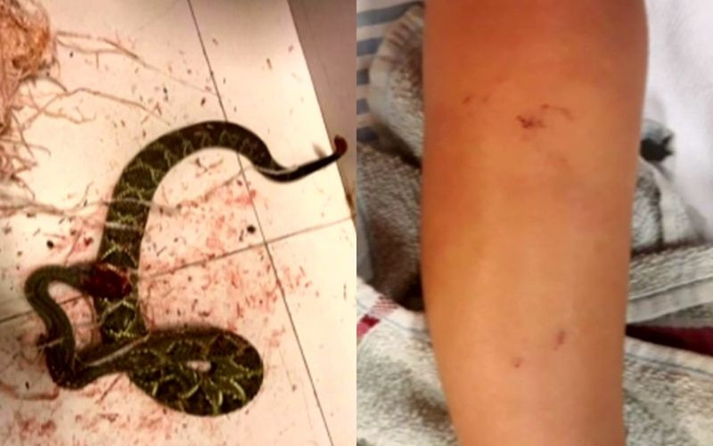 Menino sobrevive após ser picado duas vezes por cobra em Jataí — Foto: Reprodução/TV Anhanguera