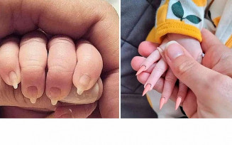 Depois que a imagem viralizou, mais fotos de bebês com unhas feitas começaram a surgir. Mais pessoas fazem esse tipo de procedimento estético nos pequenos e pequenas