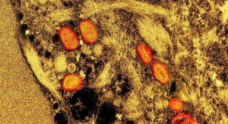 Foto: Reprodução/FLICKR NIAID - Instituto Nacional de alergia e doenças infecciosas