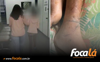 Filho acorrentado pela mãe ficava dias sem comer, sem beber água e vivia situações de extremo sofrimento, diz delegada