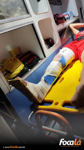 Jovem sofre suspeita de fratura durante partida de futebol em Formosa