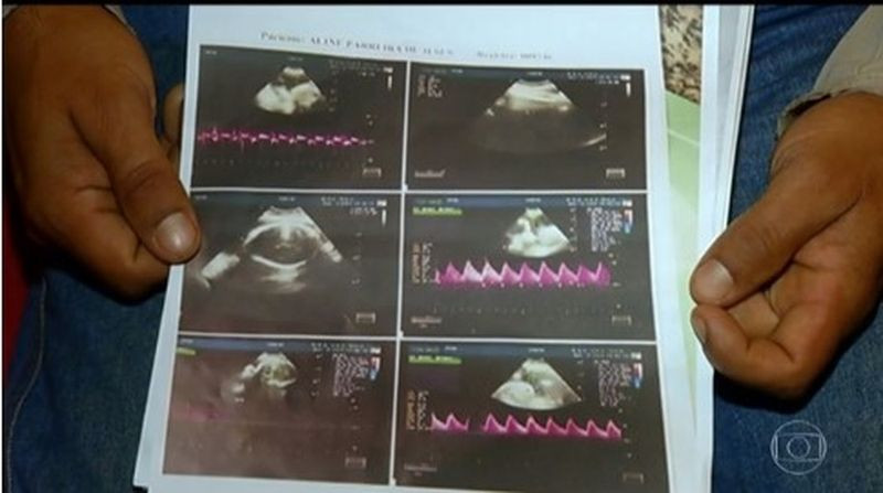 Laudo do ultrassom indica a existência de dois fetos — Foto: Reprodução/TV Globo